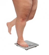 The Feet May Be Affected by Obesity