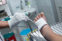 Why Caring for Wounds is Especially Important for Diabetic Patients