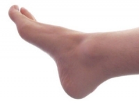 Possible Methods to Manage Plantar Hyperhidrosis