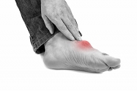 Less Common Signs of Gout